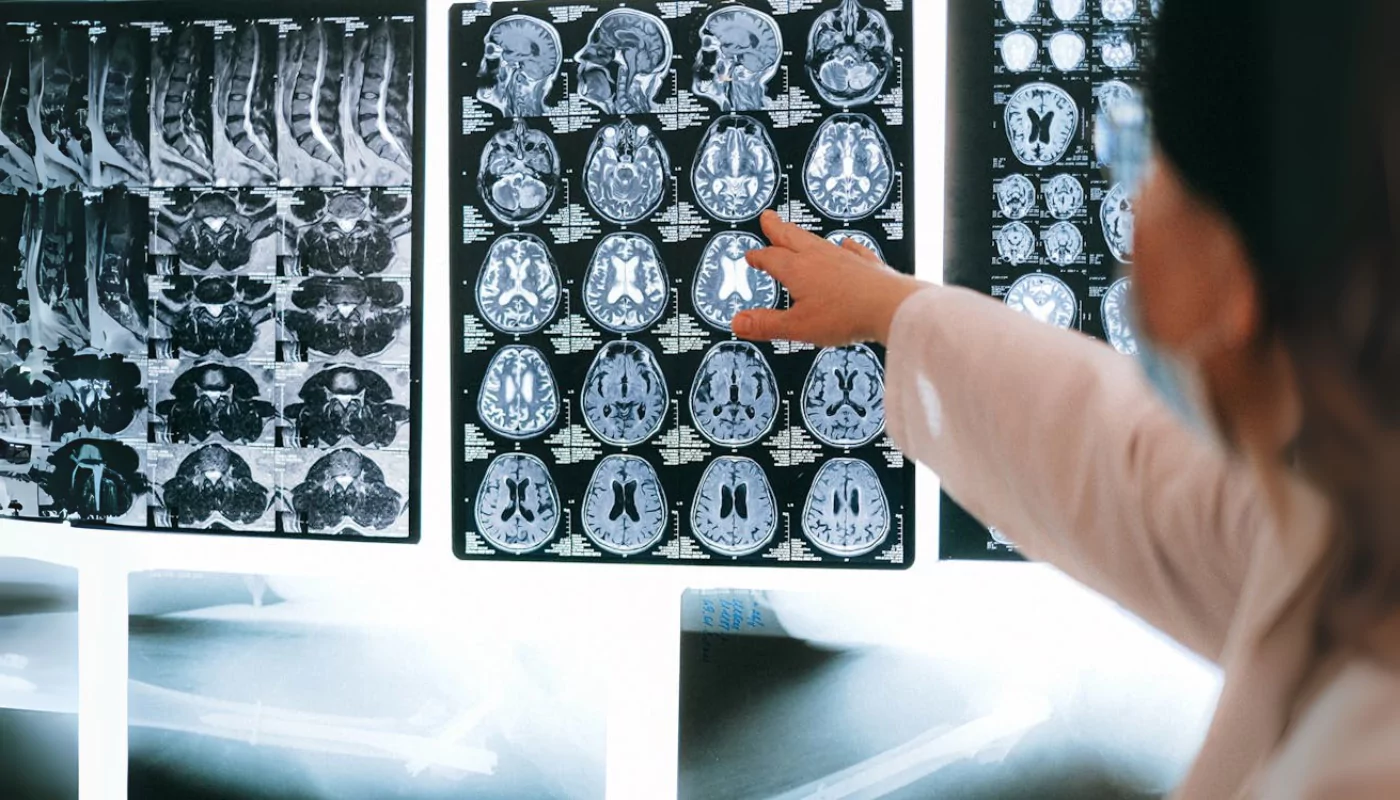 Neuropsychiatry Care in Ropar